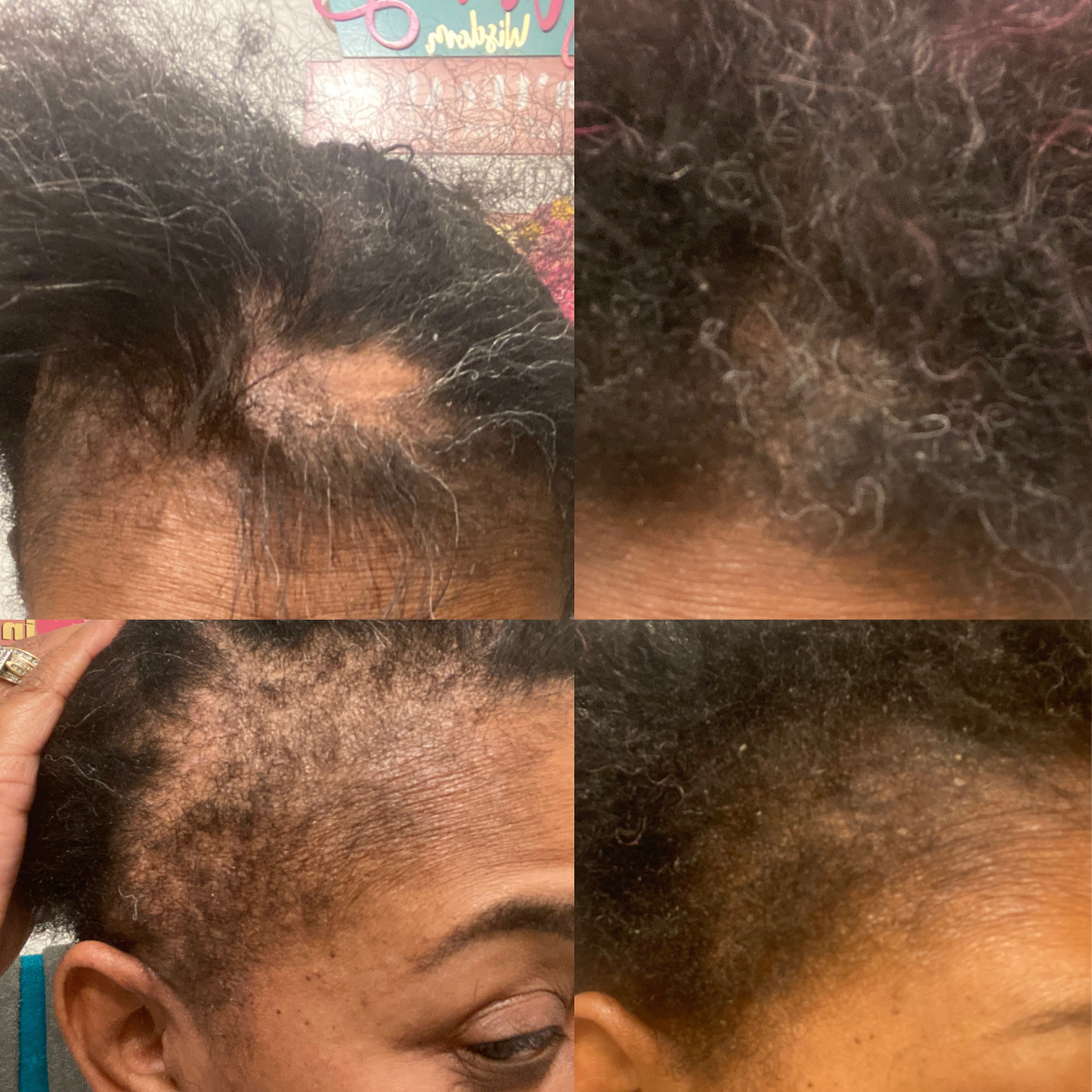 Stimulating Rosemary & Caffeine Hair Growth Oil - For Scalp, Edges & Thickness