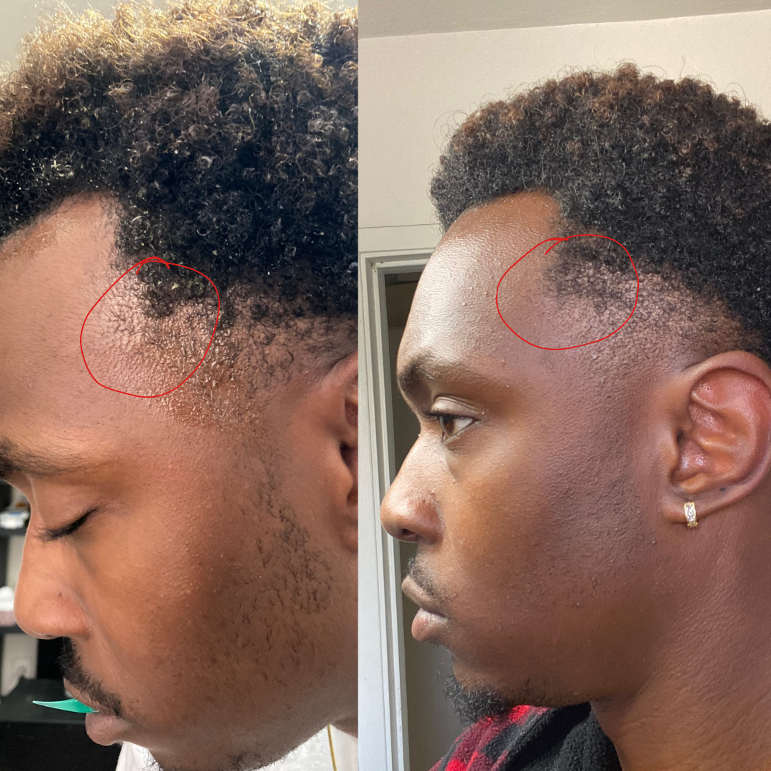 Stimulating Rosemary & Caffeine Hair Growth Oil - For Scalp, Edges & Thickness