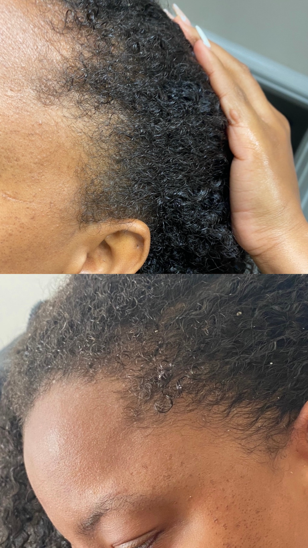 Stimulating Scalp Potion - Hair Growth Oil